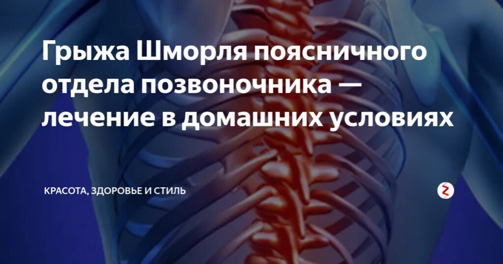 Как лечить грыжу домашний