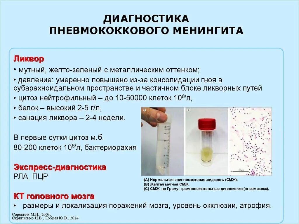 Диагностика менингококкового менингита. Анализ спинномозговой жидкости при менингококковой инфекции. Исследование ликвора при менингококковой инфекции. Спинномозговая жидкость при менингококковом менингите. Бактериоскопическое исследование спинномозговой жидкости.