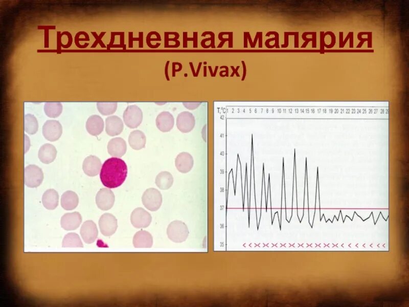 Трехдневная малярия лихорадка. Тропическая малярия лихорадка. Лихорадка при тропической малярии. Трехдневная малярия переносчик.