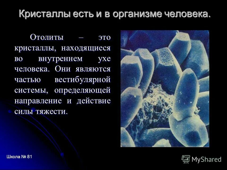 строение отолитового рецептора. отолитовый аппарат строение. волосковые клетки вестибулярного аппарата. отолиты это кристаллы. отолиты это.