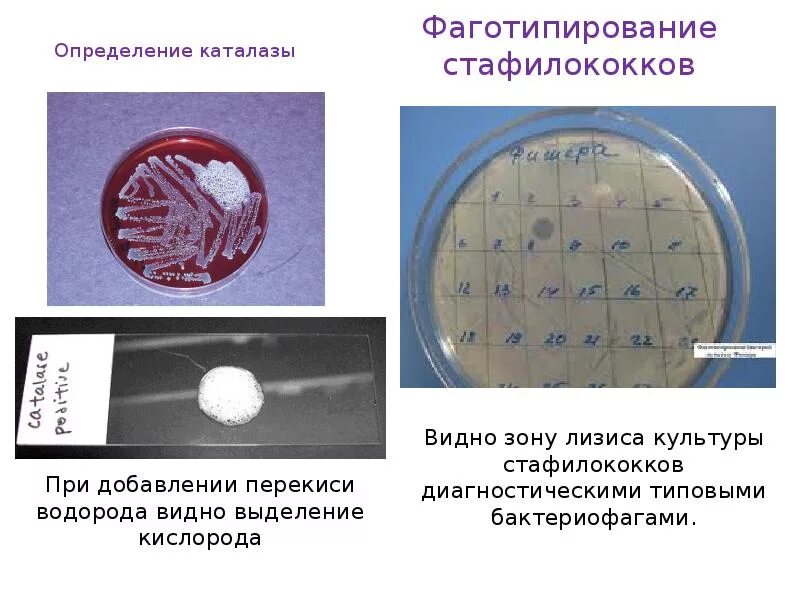 Фаготипирование это. Реакция на каталазу микробиология. фаготипирование кишечной палочки. каталаза стафилококков. фаготипирование стафилококка.