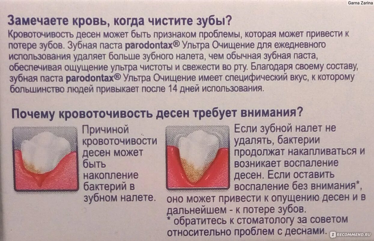 Кровотечение десен и зубов. Что означает кровь во рту