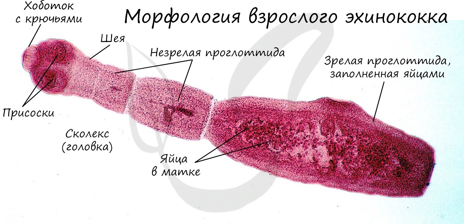 Паразиты эхинококкоз. Паразиты эхинококкоз. Строение личинки эхинококка. Ленточный червь эхинококк. Паразиты эхинококкоз.