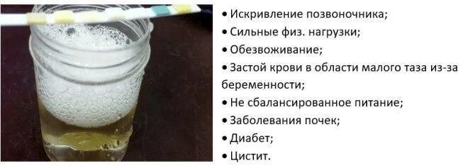 Белок в моче при беременности что значит. Белок в моче у беременных. Как выглядит белок в моче у беременных. Белок в моче у беременной причины. Белок в моче у женщины.