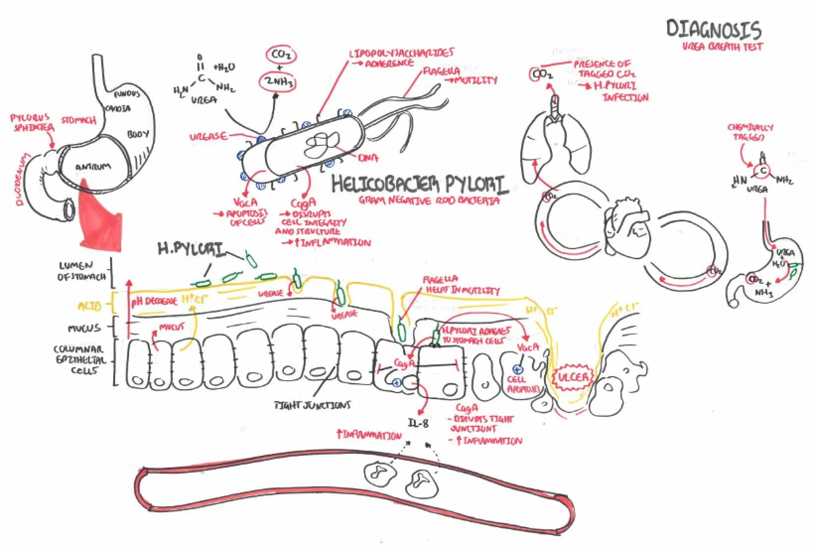 Хеликобактер язык. Факторы вирулентности h pylori. Факторы патогенности хеликобактер пилори. Белый налет язык хеликобактер пилори. Факторы вирулентности хеликобактер пилори.