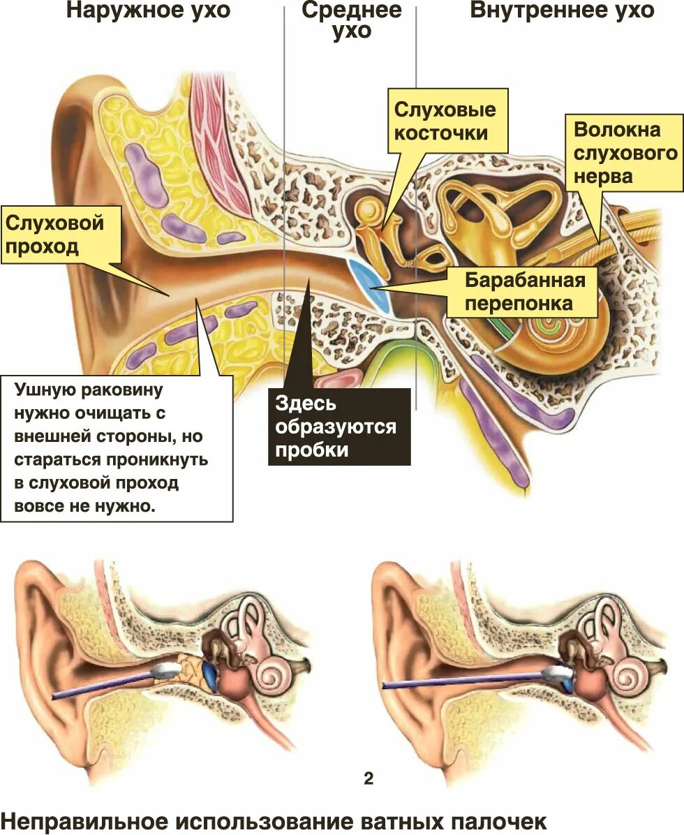 Заложило ухо ватной палочкой что делать. Строение уха серная пробка. Ухо строение серная пробка. Строение уха человека с серной пробкой. Строение уха человека серная пробка.