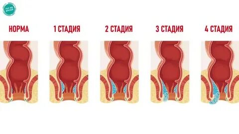 Анамның Трусики Порно Онлайн