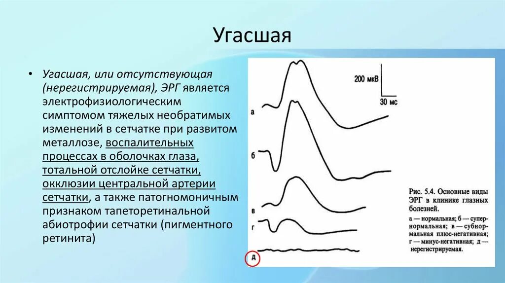 Т б волна. Электроретинография. Минус негативная эрг. Паттерн эрг. Электроретинография показания.