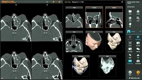 DICOM Viewer Cloud Model Access