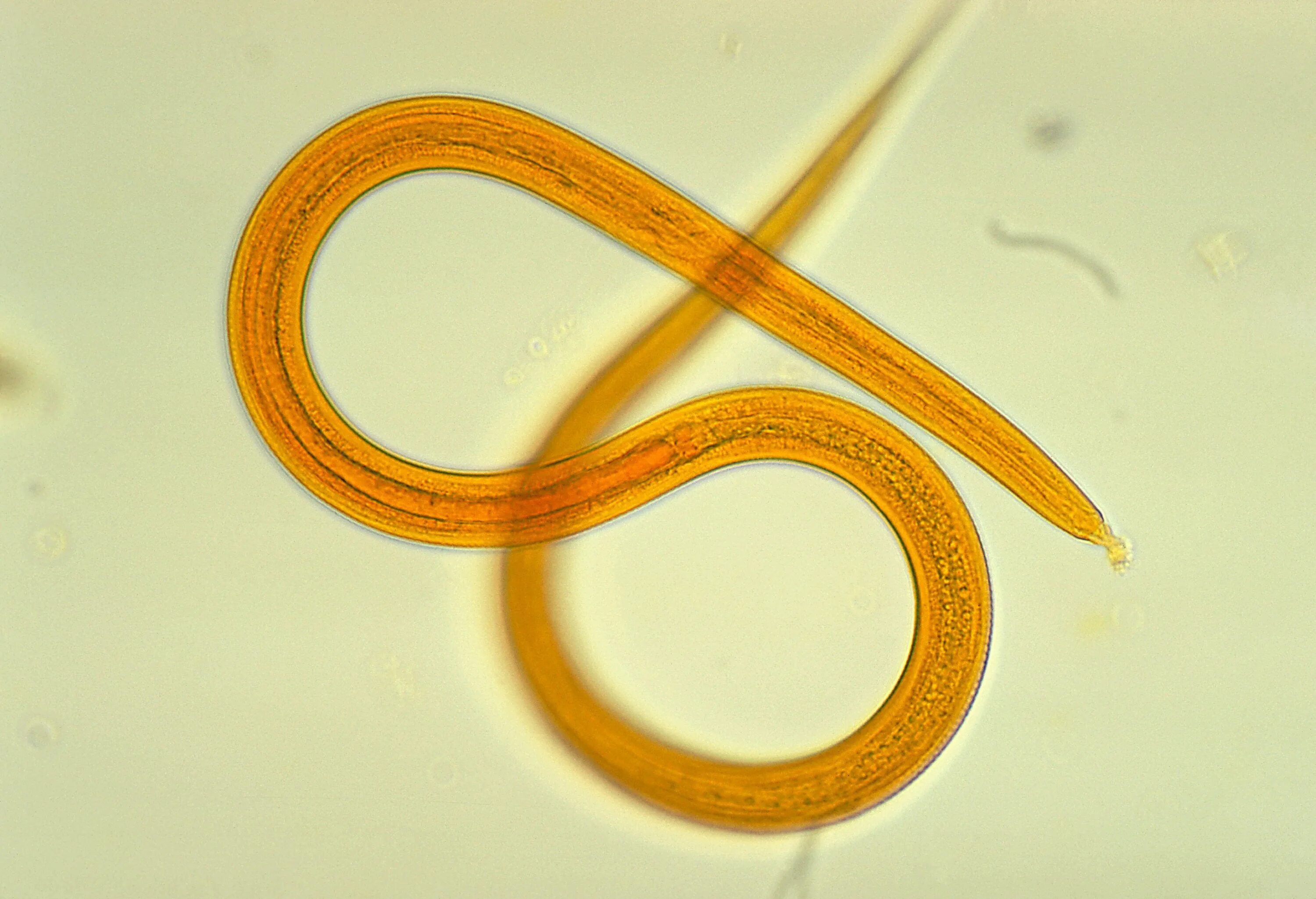 Круглые черви 3 типа. Нематод strongyloides stercoralis. Круглые глисты нематоды.