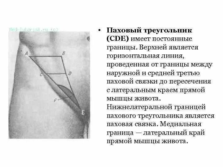 Болят ноги в паху у мужчины. Бедренный треугольник анатомия. Паховый канал треугольник промежуток. Паховая связка в бедренном треугольнике. Паховый канал границы топографическая анатомия.