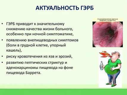 Эзофагит боли за грудиной