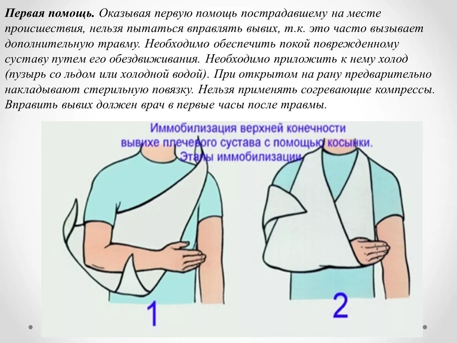 Перелом ключицы Косыночная повязка. Повязка при вывихе. Первая помощь при вывихе лучевого. Косыночная повязка при переломе ключицы.