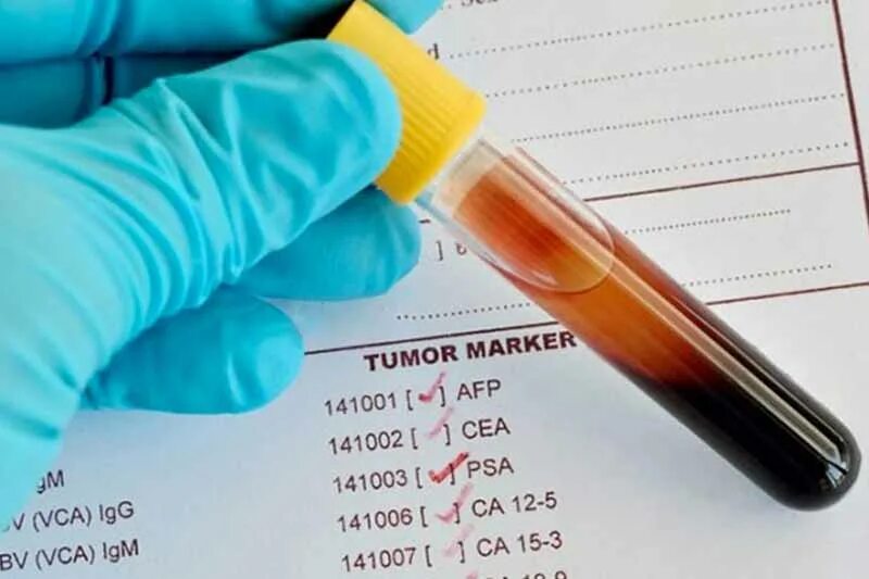 Онкомаркеры. Онкомаркеры в биохимии крови. Онкомаркеры желудка. Кровь на онкомаркеры желудка. Онкомаркеры цена спб