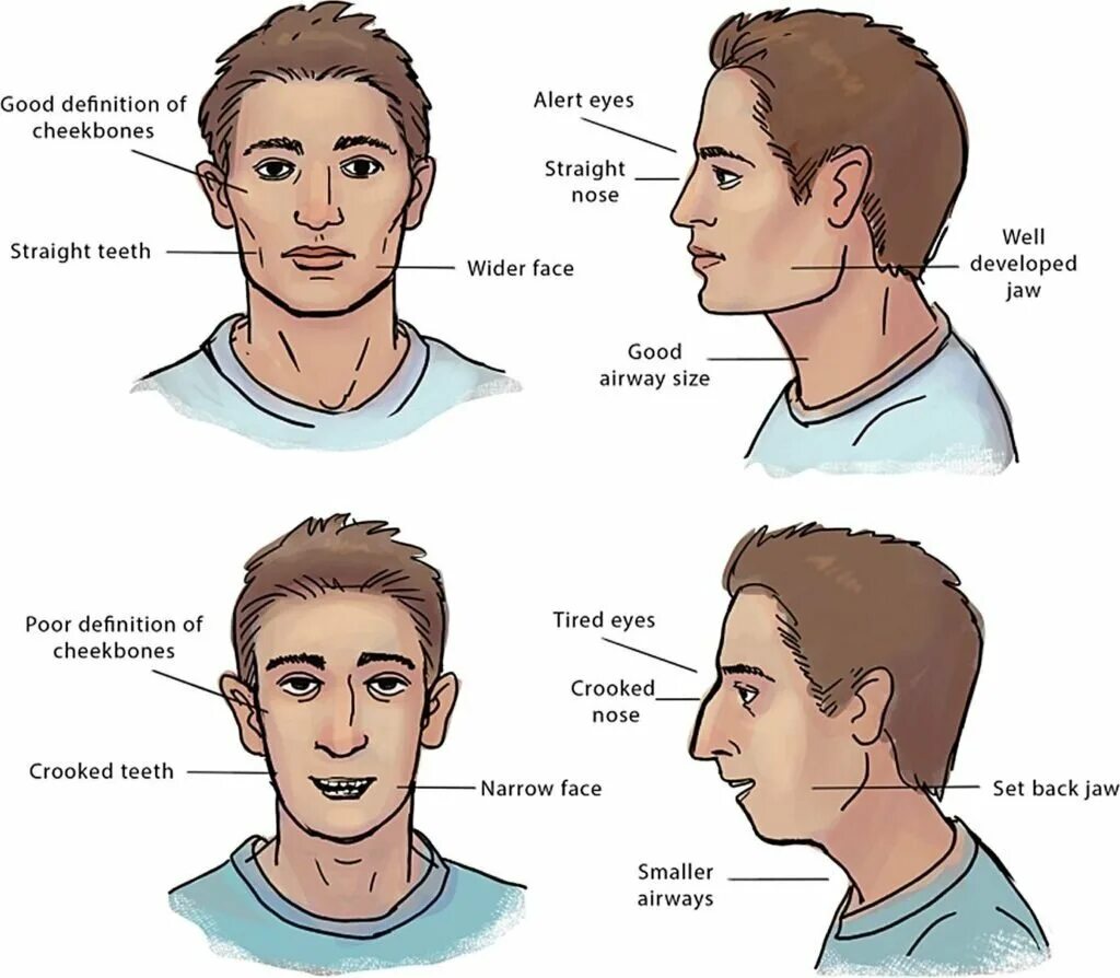 Мьюинг упражнения для лица. Chad jawline. Incel jawline. Chad челюсть. Подбородок инцела.