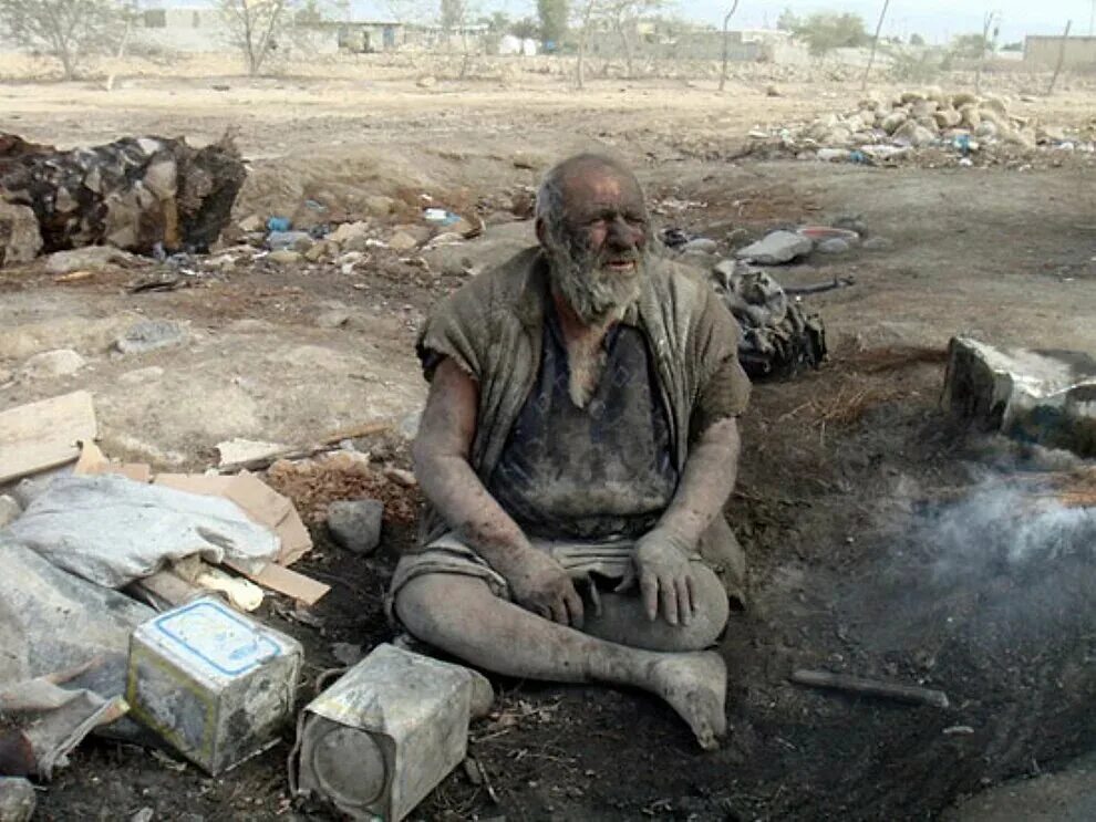 Самый грязный человек в мире Аму Хаджи. Аму Хаджи, который не мылся 60 лет.