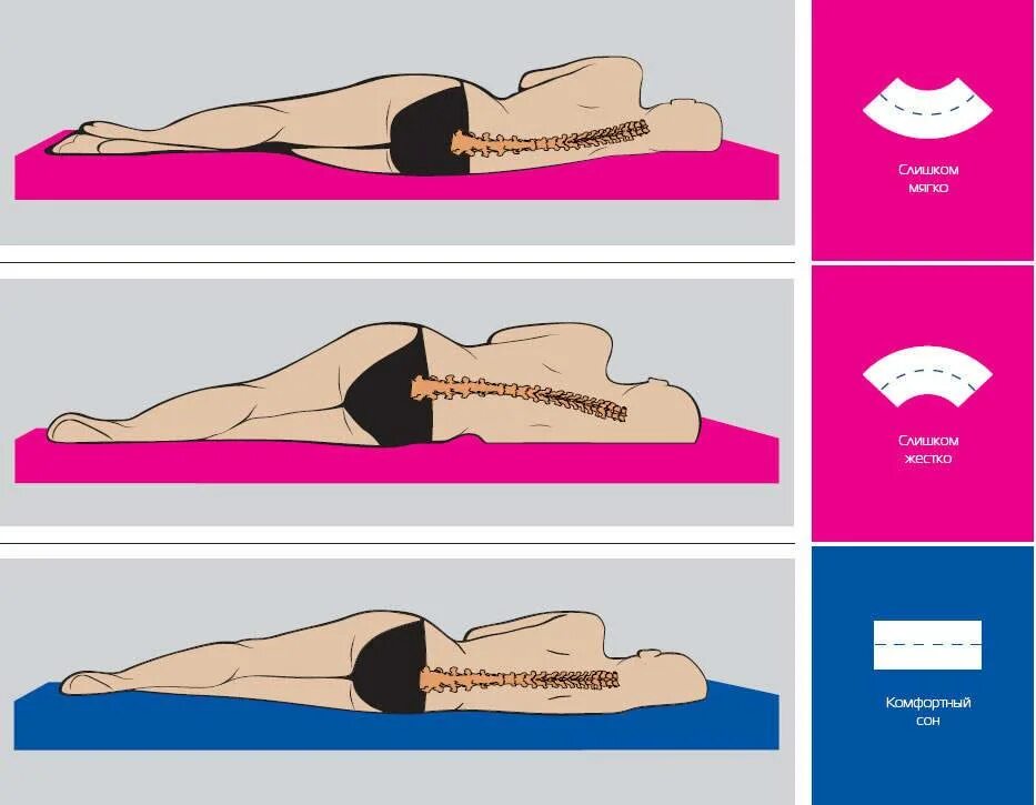 Как правильно спать чтобы не болела. Правильные позы для сна при остеохондрозе. Правильное положение для сна. Правильное положение при сне. Правильное положение позвоночника во сне.