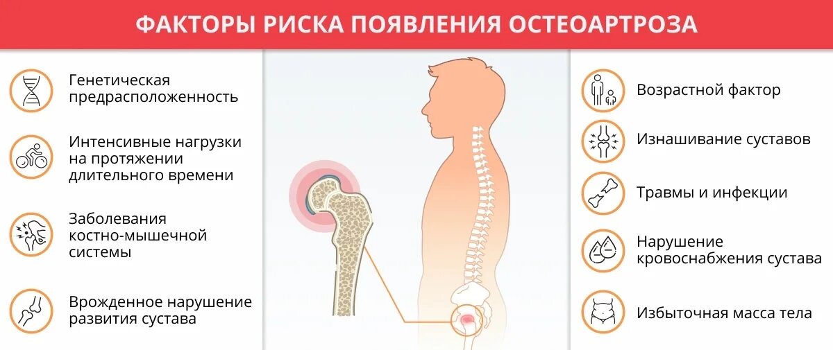 Факторы риска остеоартроза коленных суставов. Факторы риска и возникновения деформирующего остеоартроза. Факторы приводящие к развитию остеоартроза. Факторы риска развития остеоартроза.