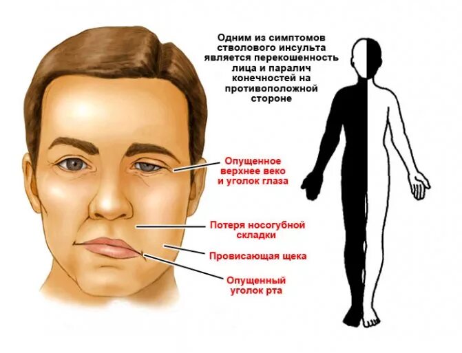 Слабость в области рта