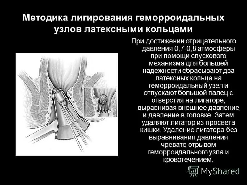 Комбилипен и суставы: побочные эффекты, инструкция