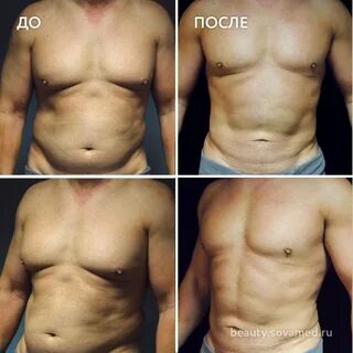 Жир на животе у мужчин
