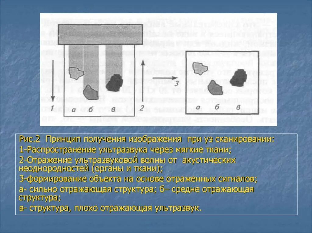 Изображение неоднородностей в тканях. При сканировании изображение будет. Два принципа получения изображения. Принцип получения изображения при ЯПМ. При сканировании изображение будет получено