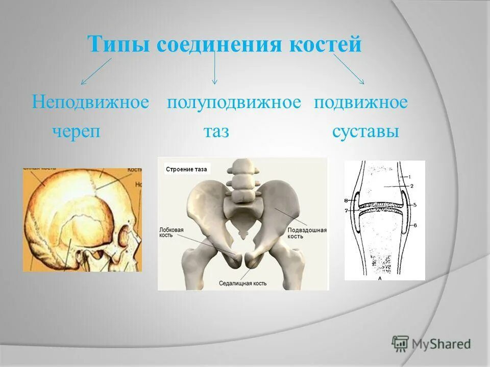 Бедренная кость тип соединения костей. Тазовые кости Тип соединения. Типы соединений костей неподвижное полуподвижное подвижное. Кости подвижные полуподвижные неподвижные полуподвижные. Тип соединения костей таза.