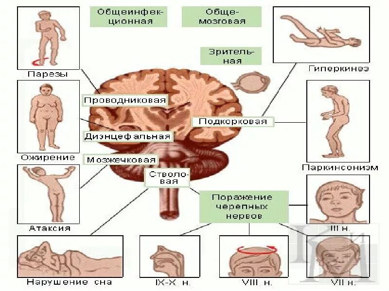 Классификация энцефалитов неврология. Энцефалиты классификация патогенез. Энцефалиты (этиология, классификация). Герпетический энцефалит классификация. Энцефалит головного мозга у взрослых