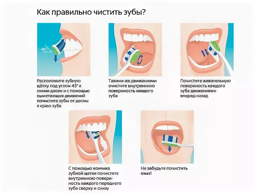 Как дома почистить зубы. Как правильно чистить зубы. как правильно чистить зубы картинки.