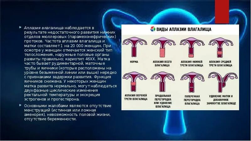 Аплазия. Аплазия. Аплазия мочеточника рентген. Аплазия. Агенезия и аплазия почки.