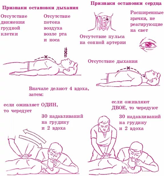 Памятка первая помощь при остановке дыхания. Первая помощь при остановке сердца и дыхания алгоритм. Первая помощь при остановке дыхания искусственное дыхание. Памятка сердечно легочная реанимация. Алгоритм оказания первой медицинской помощи при остановке дыхания.