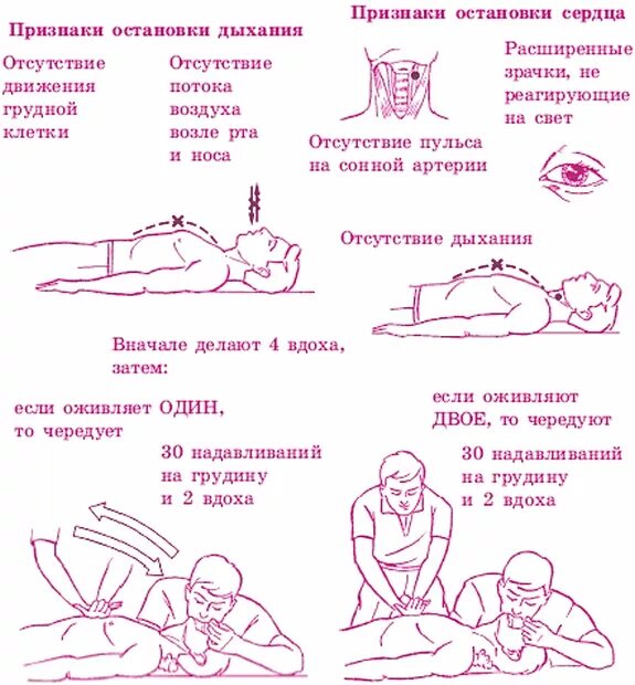 Остановка дыхания алгоритм. Схема оказания первой помощи при остановки сердца. Первая помощь при остановке сердца и дыхания алгоритм. Алгоритм проведения базовой сердечно-легочной реанимации картинки. Реанимационные мероприятия при остановке сердца алгоритм.