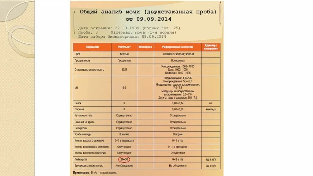 Двухстаканный анализ мочи. Общий анализ мочи двухстаканная проба. Двухстаканная и трехстаканная проба мочи. Двухстаканная проба мочи расшифровка. Трехстаканная проба мочи