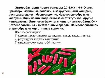 Каково значение кишечной палочки живущей в кишечнике. Каково значение кишечной палочки живущей в кишечнике