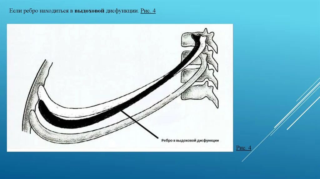 Ребра. Ребро изгиба