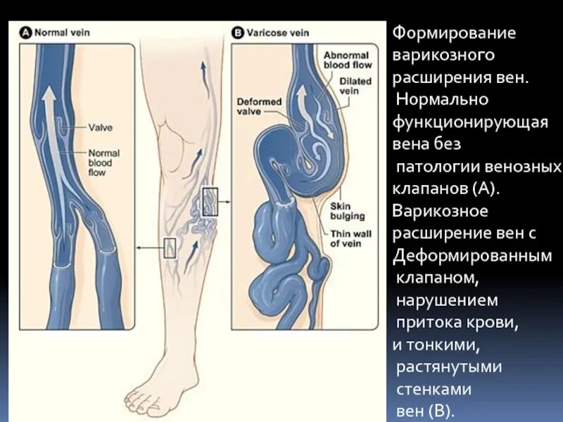Вышла вена