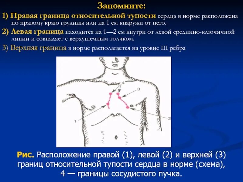 Относительная тупость. Границы относительной тупости сердца в норме. относительная тупость сердца перкуссия норма. методика определения границ относительной сердечной тупости. перкуссия границ относительной сердечной тупости в норме.