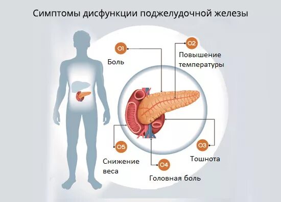 От чего может болеть поджелудочная. Поджелудочная железа симптомы. Дисфункция поджелудочной. Нарушение функции поджелудочной железы.