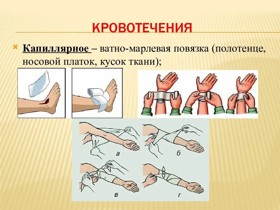 Капиллярное кровотечение. Способы остановки капиллярного кровотечения. Остановка капиллярного кровотечения. Капиллярное кровотечение первая помощь.