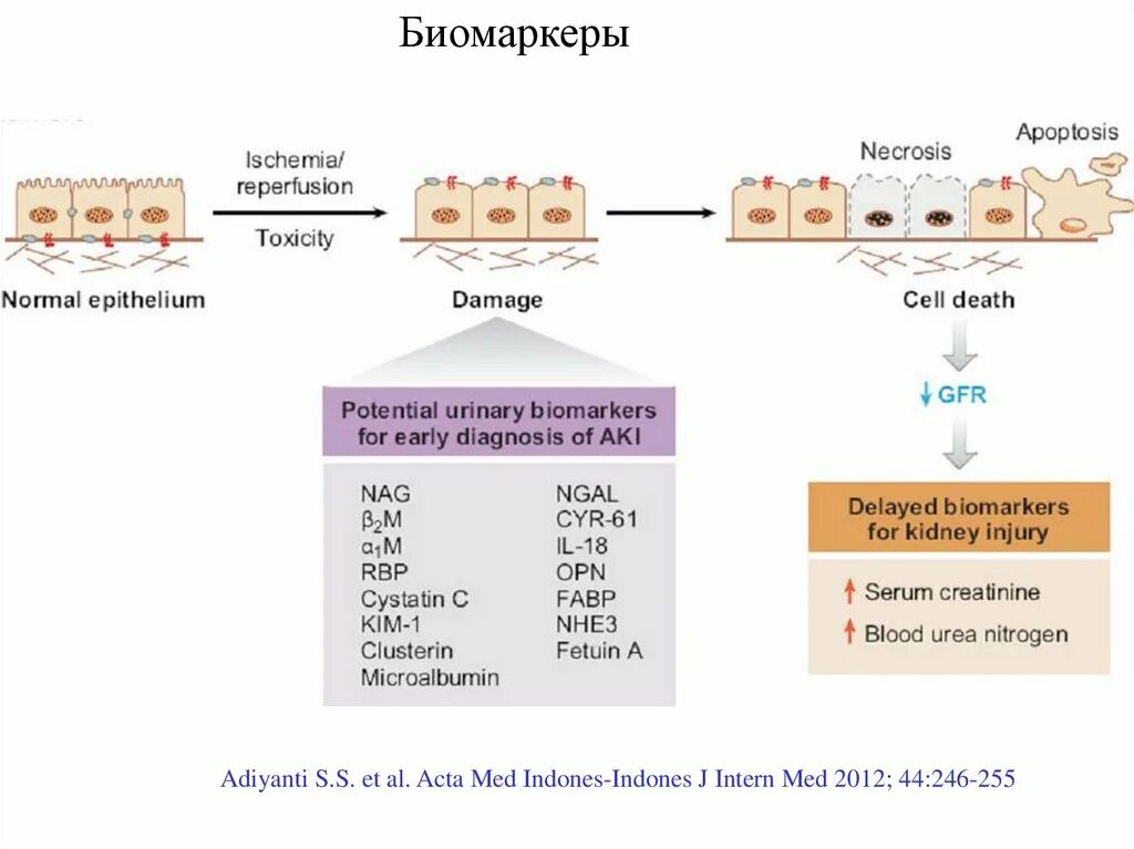 Биомаркеры это. Биомаркеры острого повреждения почек. Биохимические маркеры повреждения почек. Маркеры острого почечного повреждения. Биомаркеры раннего повреждения почек.
