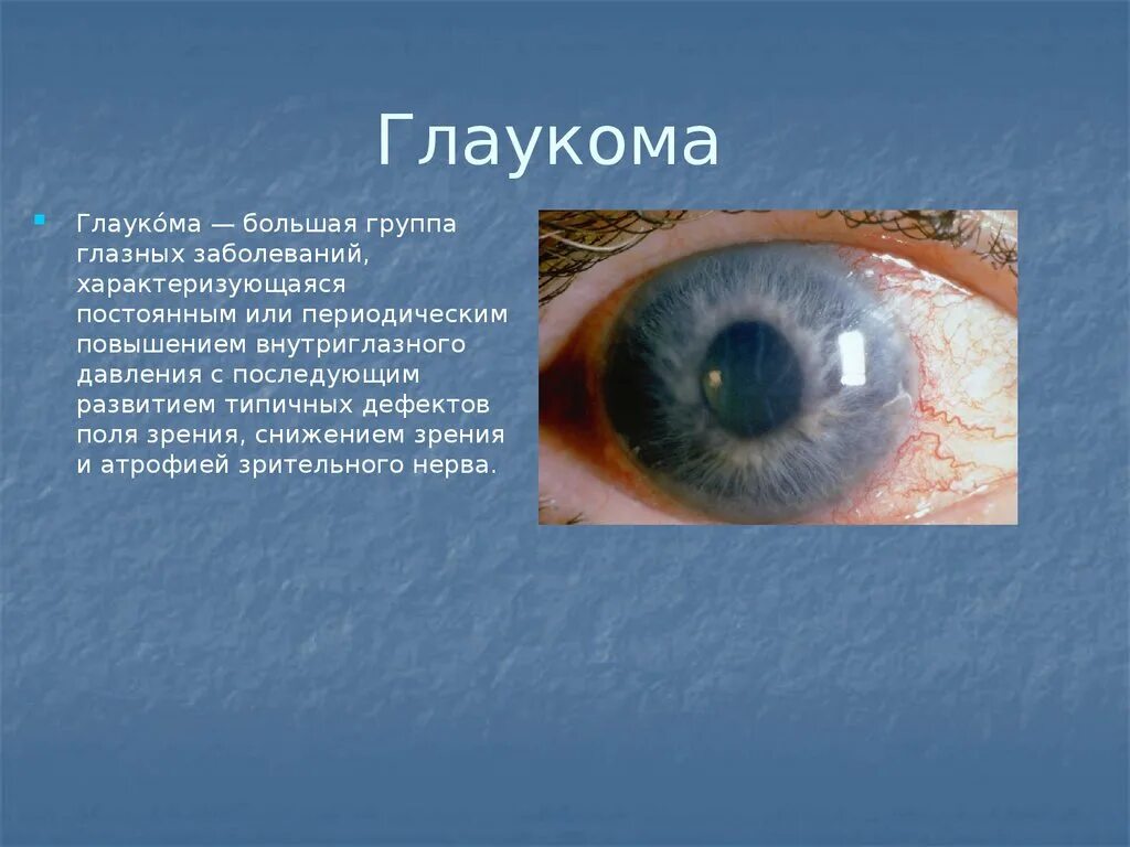 Презентация заболевания глаз. Доклад на тему заболевания глаза. Причины глаукомы глаза