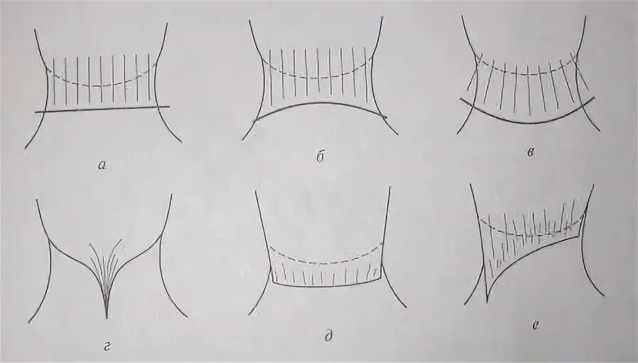 Окантовка краевой линии роста волос схема. Краевая линия роста волос схема. Схема окантовки мужских стрижек. Виды окантовок. Окантовка волос схема.