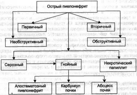 Необструктивный пиелонефрит