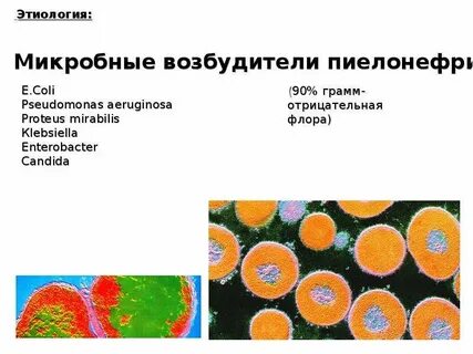 Возбудитель пиелонефрита