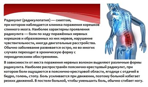Симптомы ломит