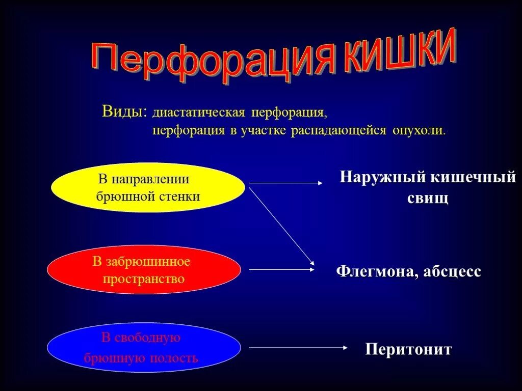 Перфорация кишки с перитонитом. Перфорация кишечника перкуссия. Диастатическая перфорация это. Что такое перфорация кишечника