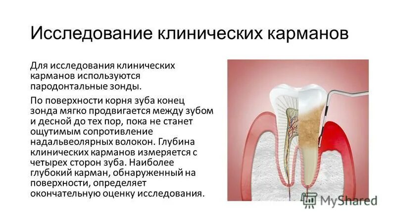 Зубной карман. Зубной карман