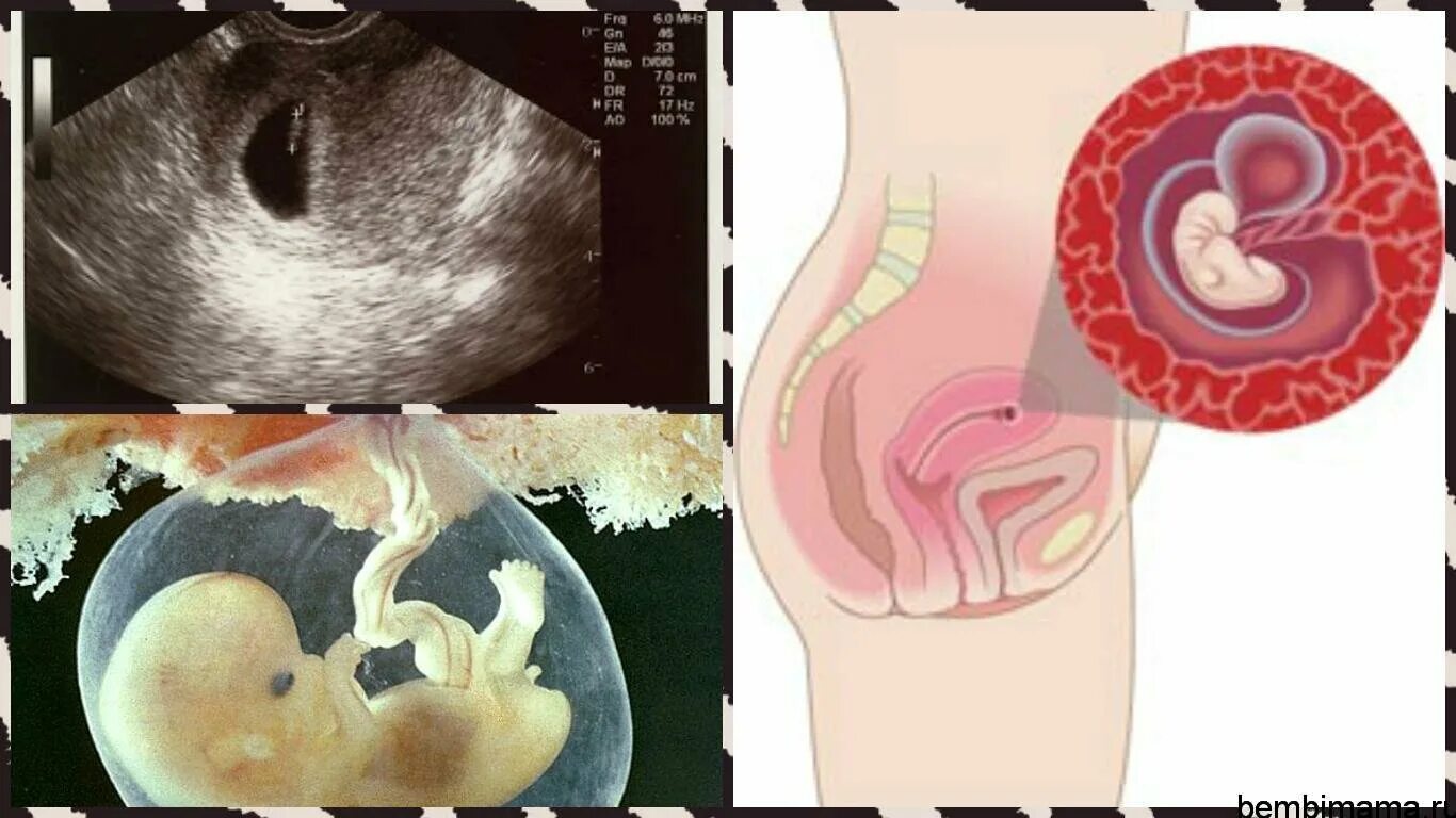 Эмбрион в матке 6 неделя беременности. Неразвивающаяся беременность 4 недели. Что происходит в первую беременность