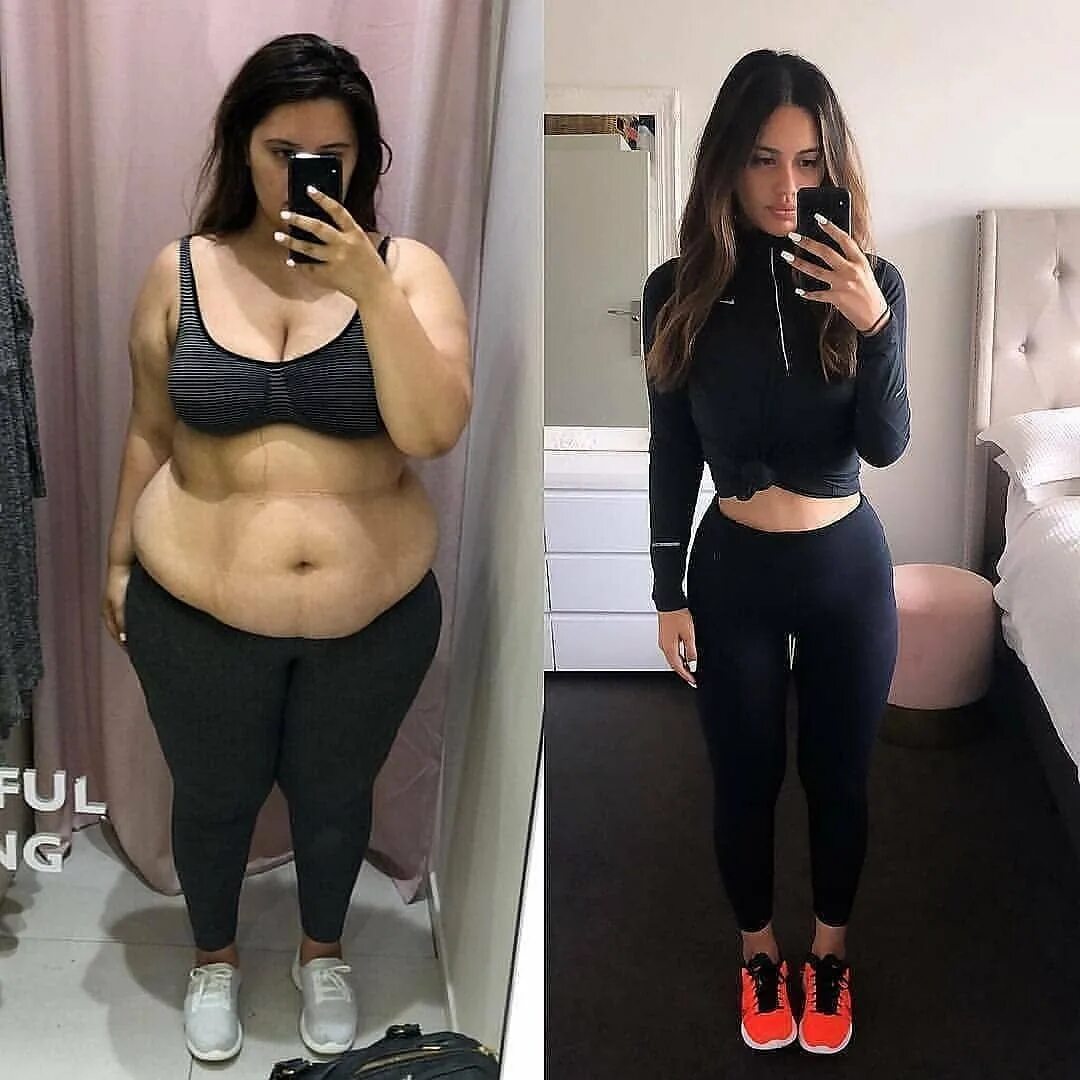 Худые жирные женщины. Похудение до и после. До и после похудения девушки. Полные девушки до и после.