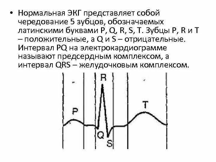 Что значит зубец р на экг. Экг зубцы и интервалы. экг расшифровка зубцов. зазубренный зубец r на экг.